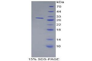 SDS-PAGE (SDS) image for Bone Marrow Stromal Cell Antigen 1 (BST1) (AA 63-313) protein (His tag) (ABIN2124136) (BST1 Protein (AA 63-313) (His tag))