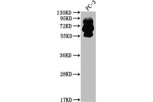 Western Blot Positive WB detected in: PC-3 whole cell lysate All lanes: PCSK9 antibody at 1:2000 Secondary Goat polyclonal to rabbit IgG at 1/50000 dilution Predicted band size: 75, 21 kDa Observed band size: 60, 75 kDa (Recombinant PCSK9 anticorps)