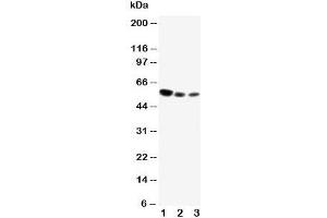 Western blot testing of CD89 antibody and Lane 1:  U87;  2: Raji;  3: Jurkat cell lysate (FCAR anticorps  (Middle Region))