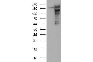 Western Blotting (WB) image for anti-ATP/GTP Binding Protein 1 (AGTPBP1) (AA 368-753) antibody (ABIN1491460) (AGTPBP1 anticorps  (AA 368-753))