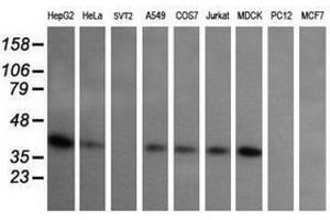 Image no. 2 for anti-Mitogen-Activated Protein Kinase Kinase 3 (MAP2K3) antibody (ABIN1499415) (MAP2K3 anticorps)