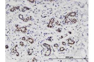 Immunoperoxidase of monoclonal antibody to C4orf43 on formalin-fixed paraffin-embedded human breast. (C4orf43 anticorps  (AA 1-203))