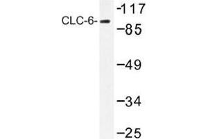 Image no. 1 for anti-Chloride Channel, Voltage-Sensitive 6 (CLCN6) antibody (ABIN317827) (CLCN6 anticorps)