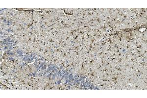 IHC analysis of GFAP using anti-GFAP antibody (ABIN7602675).