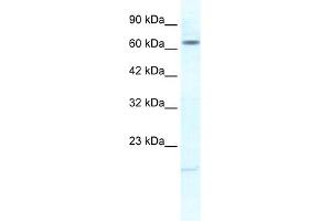 WB Suggested Anti-KCNH6 Antibody Titration:  1. (KCNH6 anticorps  (N-Term))