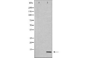 Western blot analysis of Hela whole cell lysates, using Histone H4K20me3 Antibody. (Histone H4 anticorps  (3meLys20))