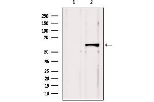 Western blot analysis of extracts from Hela, using CBS Antibody. (CBS anticorps  (Internal Region))