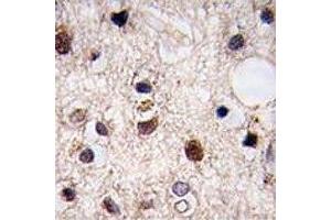 IHC analysis of FFPE human brain tissue stained with JMJD3