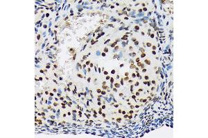 Immunohistochemistry of paraffin-embedded rat ovary using SF3B1 Rabbit mAb (ABIN7270542) at dilution of 1:100 (40x lens). (SF3B1 anticorps)