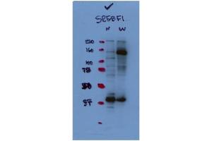 WB Suggested Antibody Titration:  1:1,000   Positive Control:  HepG2 (SREBF1 anticorps  (N-Term))