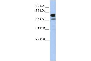 WB Suggested Anti-LDHD Antibody Titration: 0. (LDHD anticorps  (Middle Region))