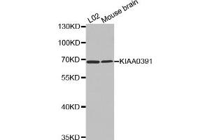Western Blotting (WB) image for anti-KIAA0391 (KIAA0391) antibody (ABIN1875480) (KIAA0391 anticorps)