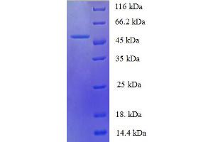 SDS-PAGE (SDS) image for Interleukin 6 (IL6) (AA 30-208) protein (GST tag) (ABIN5709751)