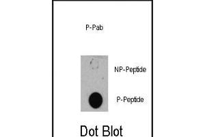 Dot blot analysis of anti-TSC1-p Phospho-specific Pab (R) on nitrocellulose membrane. (TSC1 anticorps  (pSer505))