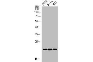 Western Blot analysis of 293T Hela 823 cells using ANG I Polyclonal Antibody (ANG anticorps  (N-Term))