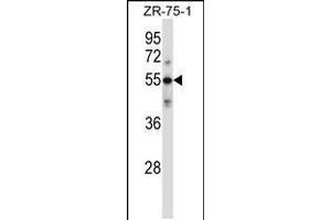 Western blot analysis in ZR-75-1 cell line lysates (35ug/lane). (C9 anticorps  (AA 191-220))