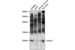 Western blot analysis of extracts of various cell lines, using B antibody (ABIN7265827) at 1:3000 dilution.
