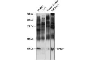 Western blot analysis of extracts of various cell lines, using B antibody (ABIN7265827) at 1:3000 dilution. (BANF1 anticorps  (AA 1-89))