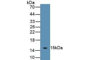 Detection of Recombinant CHRM3, Human using Polyclonal Antibody to Cholinergic Receptor, Muscarinic 3 (CHRM3) (CHRM3 anticorps  (AA 1-104))