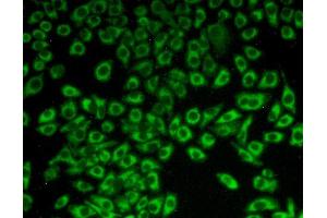Figure:FITC staining on IHC-P Simple: Hela cells (C1QBP anticorps  (AA 71-278))
