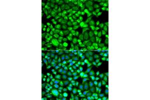 Immunofluorescence analysis of A549 cells using PSMB8 antibody. (PSMB8 anticorps  (AA 163-272))