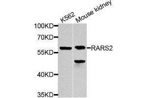 Western blot analysis of extracts of K562 and mouse kidney cells, using RARS2 antibody.