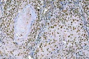 anti-Antigen Identified By Monoclonal Antibody Ki-67 (MKI67) (AA 5-2358) antibody