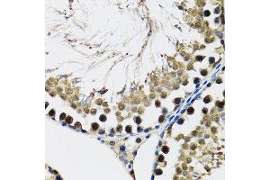 Immunohistochemistry of paraffin-embedded rat testis using DDX41 antibody. (DDX41 anticorps  (AA 1-300))