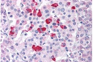 Pancreas (BACE1 anticorps  (Internal Region))