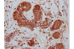 anti-Cytotoxic T-Lymphocyte-Associated Protein 4 (CTLA4) (AA 37-162) antibody