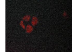 ABIN6269097 staining Hela cells by ICC/IF.
