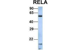 Host:  Rabbit  Target Name:  RELA  Sample Type:  Human Hela  Antibody Dilution:  1.