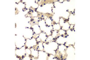 Immunohistochemistry of paraffin-embedded mouse lung using CXXC1 antibody. (CXXC1 anticorps)