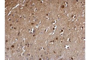 IHC-P Image DCK antibody detects DCK protein at nucleus on mouse hind brain by immunohistochemical analysis. (DCK anticorps)