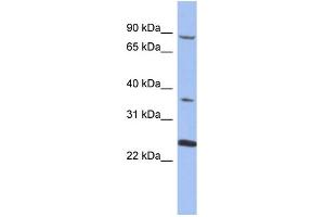 WB Suggested Anti-MPP3  Antibody Titration: 0.