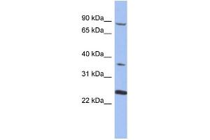 WB Suggested Anti-MPP3  Antibody Titration: 0. (MPP3 anticorps  (N-Term))