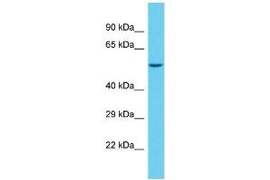Host: Rabbit Target Name: SAMD1 Sample Type: NCI-H226 Whole Cell lysates Antibody Dilution: 1. (SAMD1 anticorps  (C-Term))
