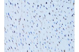 Immunohistochemistry of paraffin-embedded rat heart using FABP4 antibody (ABIN5970061) at dilution of 1/100 (40x lens). (FABP4 anticorps)