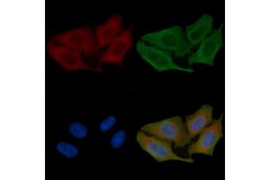 ABIN6261751 and ABIN6266842 staining Hela cells(45 min of heat-shock) by IF/ICC. (FARP2 anticorps  (Internal Region))