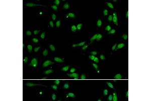 Immunofluorescence analysis of A549 cells using ANP32A Polyclonal Antibody (PHAP1 anticorps)
