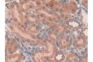 Detection of LOX1 in Rat Kidney Tissue using Polyclonal Antibody to Lectin Like Oxidized Low Density Lipoprotein Receptor 1 (LOX1) (OLR1 anticorps  (AA 51-314))