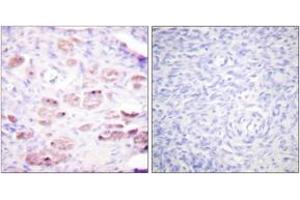 Immunohistochemistry analysis of paraffin-embedded human ovary, using Daxx (Phospho-Ser668) Antibody.