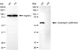 Western blotting analysis using asparagine synthetase antibody (ABIN7797662).