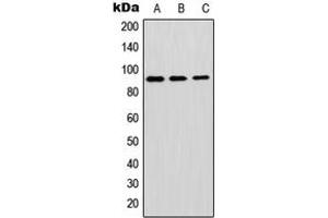 Western blot analysis of GPIPLD expression in A549 (A), mouse brain (B), H9C2 (C) whole cell lysates. (GPLD1 anticorps  (Center))