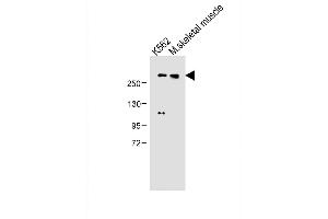 All lanes : Anti-ADTS13 Antibody (Center) at 1:500 dilution Lane 1: K562 whole cell lysate Lane 2: M. (ADAMTS13 anticorps  (AA 829-858))