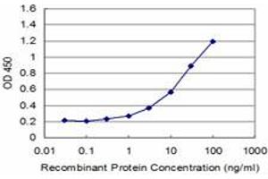 anti-Speckle-Type POZ Protein (SPOP-B) (AA 301-374) antibody