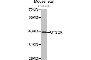 Western Blotting (WB) image for anti-Urotensin 2 Receptor (UTS2R) (AA 280-389) antibody (ABIN6219939) (UTS2R anticorps  (AA 280-389))