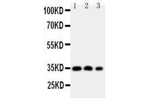 Anti-HOXA4 antibody, Western blotting Lane 1: SW620 Cell Lysate Lane 2: SW620 Cell Lysate Lane 3: PC-12 Cell Nuclear Lysate (HOXA4 anticorps  (N-Term))