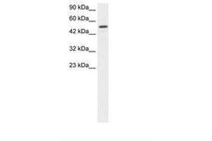 Image no. 1 for anti-Estrogen-Related Receptor gamma (ESRRG) (AA 190-239) antibody (ABIN202522) (ESRRG anticorps  (AA 190-239))