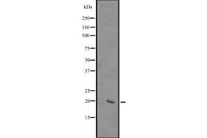 Western blot analysis of SIVA expression in HEK293 cells ,The lane on the left is treated with the antigen-specific peptide. (SIVA1 anticorps  (Internal Region))